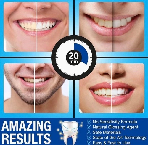 Teeth whitening kit - teeth,