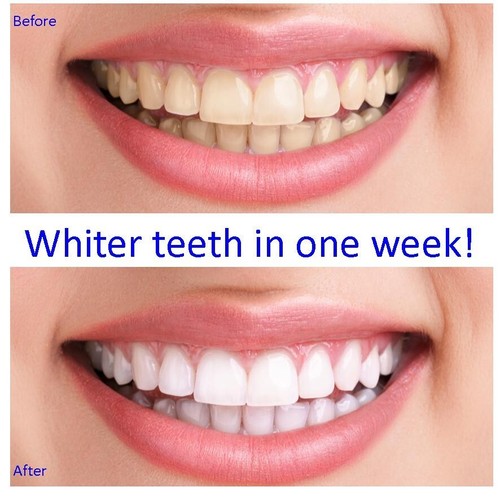 Very strong teeth - very,